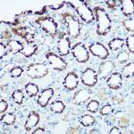 UQCRC2 Antibody in Immunohistochemistry (Paraffin) (IHC (P))