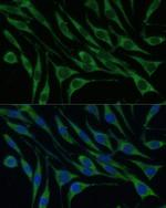 VARS Antibody in Immunocytochemistry (ICC/IF)