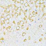 VARS Antibody in Immunohistochemistry (Paraffin) (IHC (P))