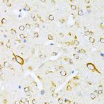 VARS Antibody in Immunohistochemistry (Paraffin) (IHC (P))