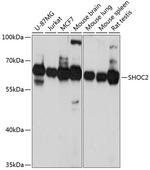 SHOC2 Antibody in Western Blot (WB)