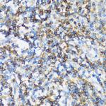 ARHGEF1 Antibody in Immunohistochemistry (Paraffin) (IHC (P))