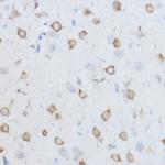 TCP-1 theta Antibody in Immunohistochemistry (Paraffin) (IHC (P))