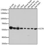 TCP-1 theta Antibody in Western Blot (WB)