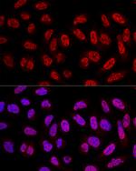 SF3A3 Antibody in Immunocytochemistry (ICC/IF)