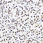 SF3A3 Antibody in Immunohistochemistry (Paraffin) (IHC (P))