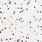 SF3A3 Antibody in Immunohistochemistry (Paraffin) (IHC (P))