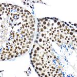 SF3A3 Antibody in Immunohistochemistry (Paraffin) (IHC (P))