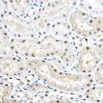 SF3A3 Antibody in Immunohistochemistry (Paraffin) (IHC (P))