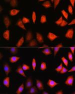 KAP3 Antibody in Immunocytochemistry (ICC/IF)