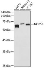 NOP58 Antibody in Western Blot (WB)