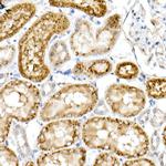 NPC2 Antibody in Immunohistochemistry (Paraffin) (IHC (P))