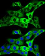 GARS Antibody in Immunocytochemistry (ICC/IF)