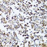 GARS Antibody in Immunohistochemistry (Paraffin) (IHC (P))