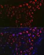 MGP Antibody in Immunohistochemistry (Paraffin) (IHC (P))