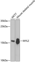 MYL2 Antibody in Western Blot (WB)