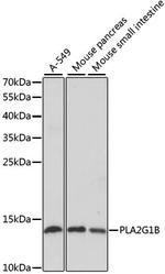 PLA2 Antibody in Western Blot (WB)