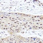 PSMB2 Antibody in Immunohistochemistry (Paraffin) (IHC (P))