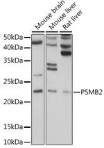 PSMB2 Antibody in Western Blot (WB)