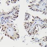 SNRPE Antibody in Immunohistochemistry (Paraffin) (IHC (P))