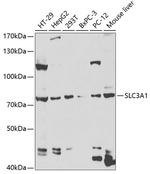 SLC3A1 Antibody in Western Blot (WB)