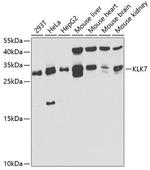 Kallikrein 7 Antibody in Western Blot (WB)