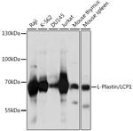 L-Plastin Antibody in Western Blot (WB)