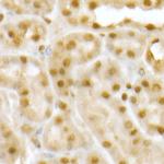 RNF2 Antibody in Immunohistochemistry (Paraffin) (IHC (P))