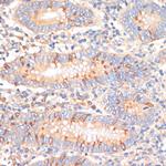 WNK3 Antibody in Immunohistochemistry (Paraffin) (IHC (P))