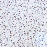 SKIV2L2 Antibody in Immunohistochemistry (Paraffin) (IHC (P))