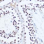 SKIV2L2 Antibody in Immunohistochemistry (Paraffin) (IHC (P))