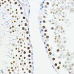 ZEB1 Antibody in Immunohistochemistry (Paraffin) (IHC (P))