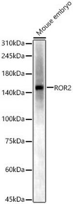 ROR2 Antibody in Western Blot (WB)