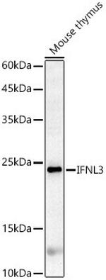 IL-28B Antibody in Western Blot (WB)