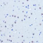 PIAS2 Antibody in Immunohistochemistry (Paraffin) (IHC (P))