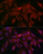 SMAD4 Antibody in Immunocytochemistry (ICC/IF)