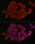 SMAD4 Antibody in Immunocytochemistry (ICC/IF)