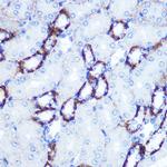 SMAD4 Antibody in Immunohistochemistry (Paraffin) (IHC (P))