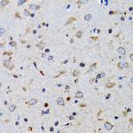 TWEAK Antibody in Immunohistochemistry (Paraffin) (IHC (P))