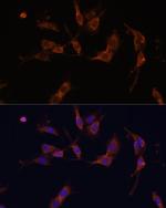 IQGAP1 Antibody in Immunocytochemistry (ICC/IF)