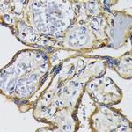 IQGAP1 Antibody in Immunohistochemistry (Paraffin) (IHC (P))