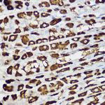 BNIP3 Antibody in Immunohistochemistry (Paraffin) (IHC (P))