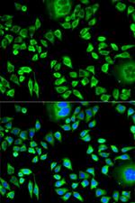 Cystatin A Antibody in Immunocytochemistry (ICC/IF)