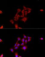 Fumarase Antibody in Immunocytochemistry (ICC/IF)