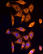 ROCK2 Antibody in Immunocytochemistry (ICC/IF)