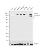 ROCK2 Antibody in Western Blot (WB)