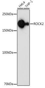 ROCK2 Antibody in Western Blot (WB)