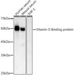 GC Antibody in Western Blot (WB)