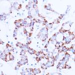 SIRT3 Antibody in Immunohistochemistry (Paraffin) (IHC (P))