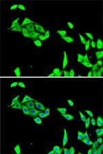 CDK5 Antibody in Immunocytochemistry (ICC/IF)